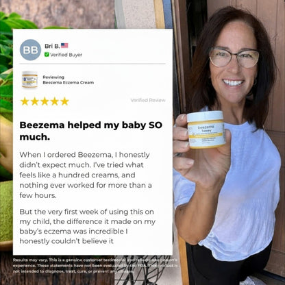 Beezema Eczema Cream