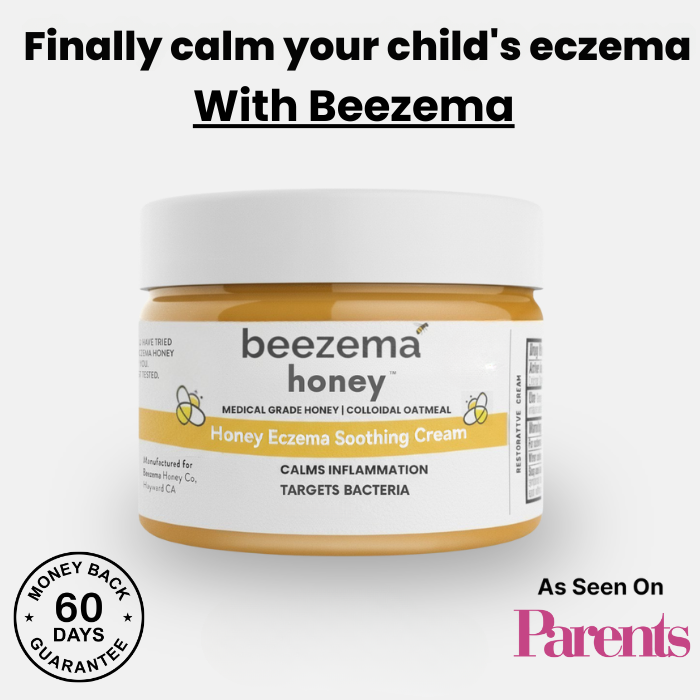 Beezema Childrens Eczema Cream