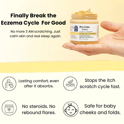 Beezema Baby Eczema Cream
