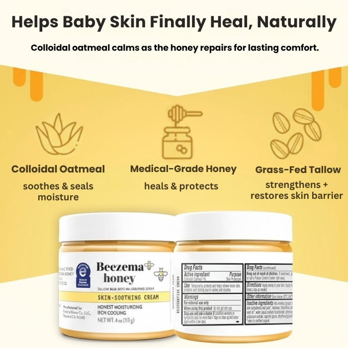 Beezema Baby Eczema Cream