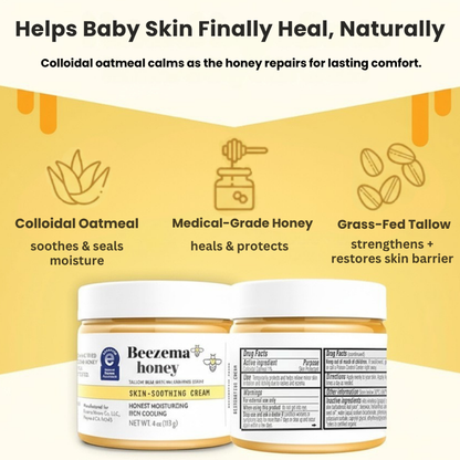 Beezema Baby Eczema Cream