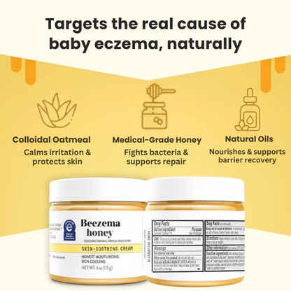 Beezema Baby Eczema Cream