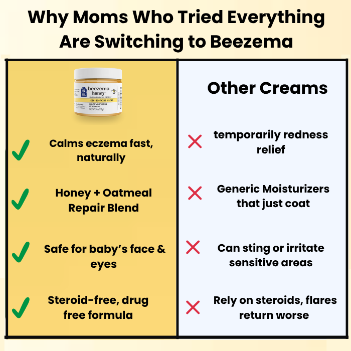 Beezema Baby Eczema Cream