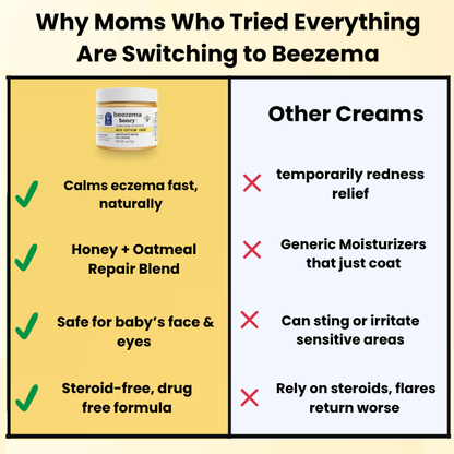Beezema Baby Eczema Cream