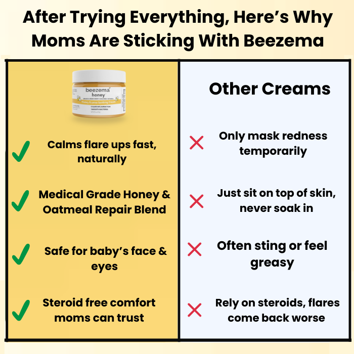 Beezema Eczema Cream