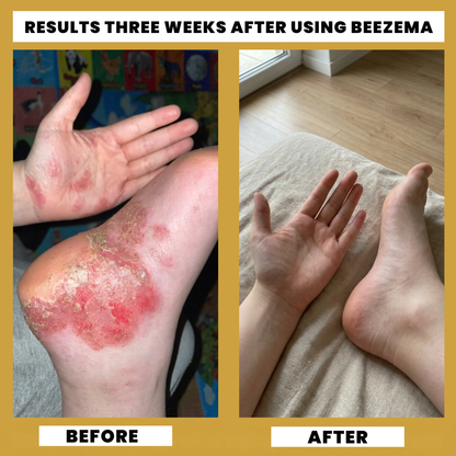 Beezema DE Cream
