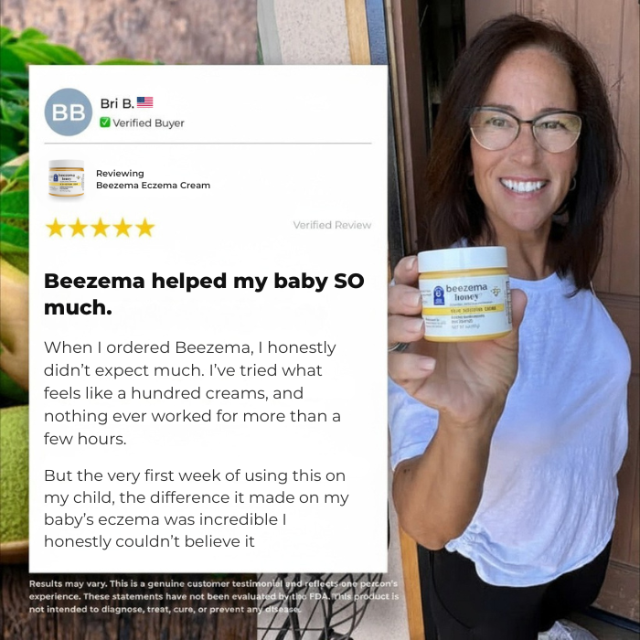 Beezema Baby Eczema Cream