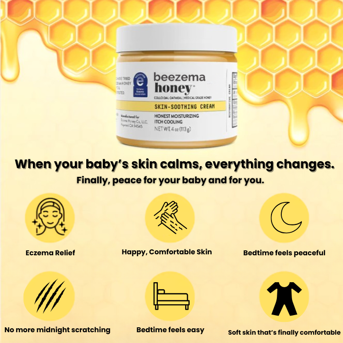 Beezema Baby Eczema Cream