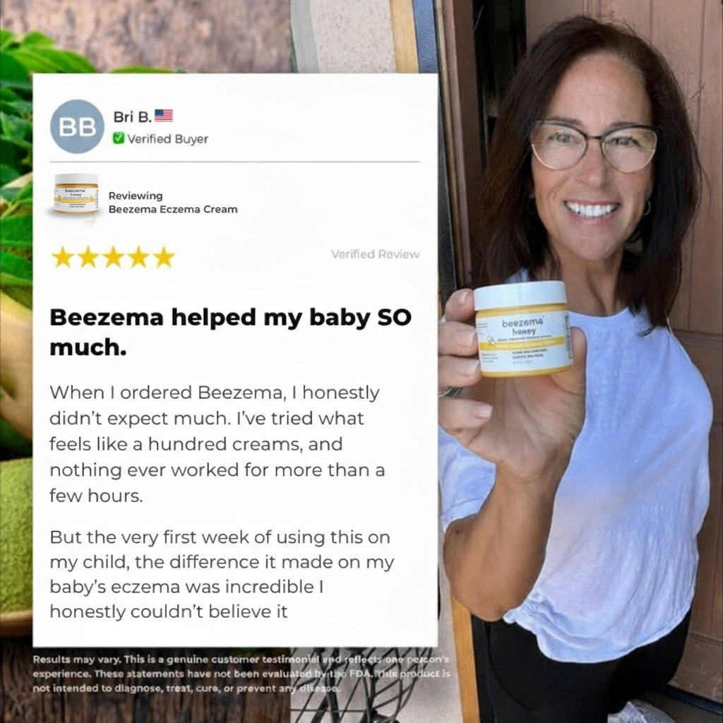Beezema Eczema Cream