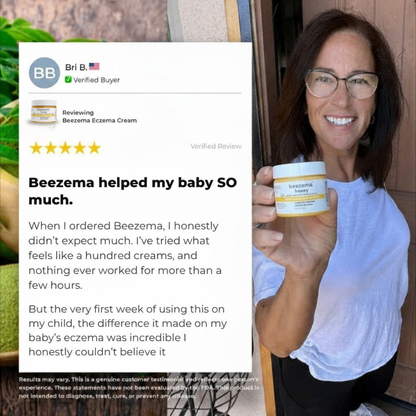 Beezema Eczema Cream