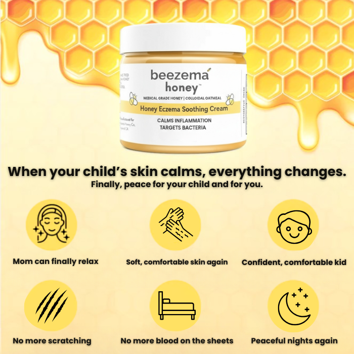 Beezema Childrens Eczema Cream