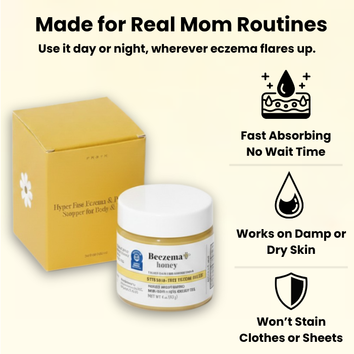 Beezema Baby Eczema Cream