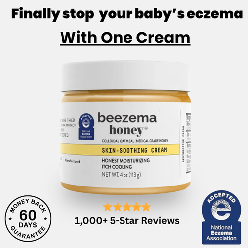 Beezema Baby Eczema Cream