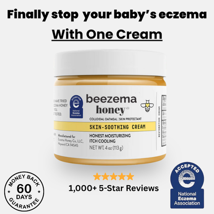 Beezema Baby Eczema Cream