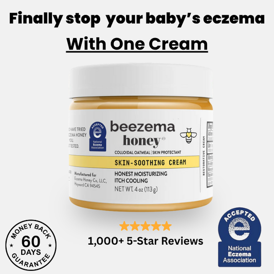 Beezema Baby Eczema Cream